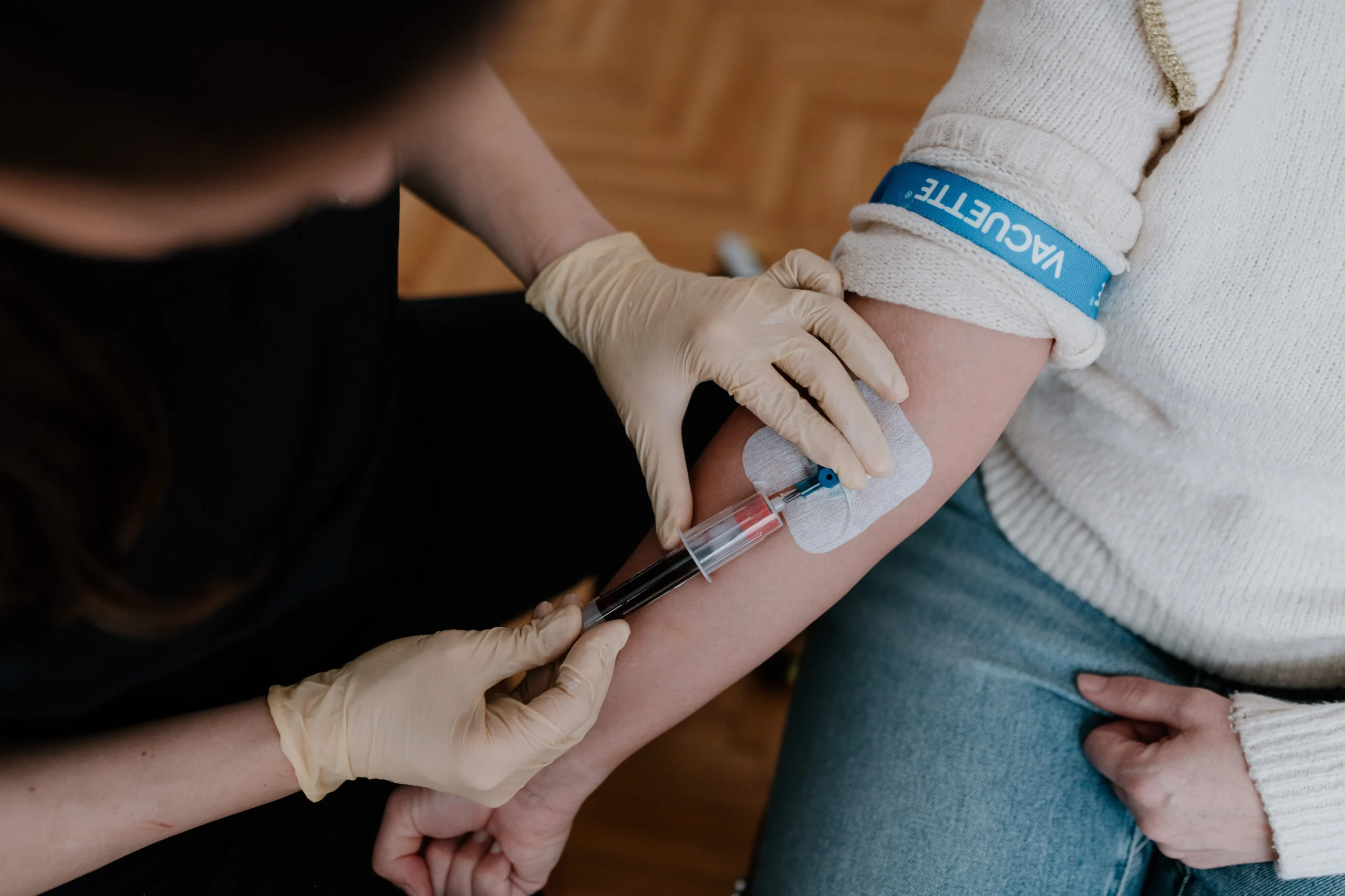 PRP Eigenblutplasma, Vampire Lifting zur Hautverjüngung im Gesicht und Körper bei Dr. Udvari